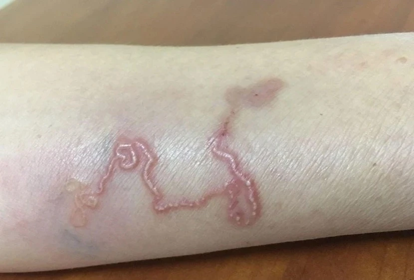 Nhóm người tuyệt đối không được quên tẩy giun Nhóm người tuyệt đối không được quên tẩy giun