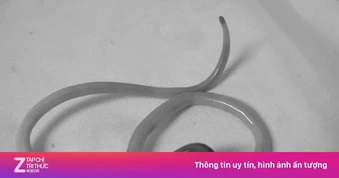 Những dấu hiệu cảnh báo cơ thể bạn đầy giun sán