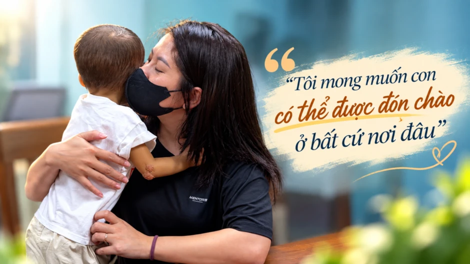 Những đứa trẻ bị kỳ thị vì màu sắc da 'lạ': Bác sĩ phải gọi điện thuyết phục hiệu trưởng