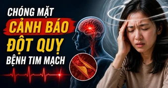 Những kiểu chóng mặt cảnh báo đột quỵ