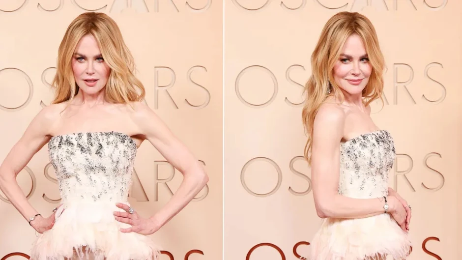 Nicole Kidman U60 da vẫn trắng mịn, căng mọng collagen: "Bí mật" chống già hóa ra là không lạm dụng 1 thứ Nicole Kidman U60 da vẫn trắng mịn, căng mọng collagen: "Bí mật" chống già hóa ra là không lạm dụng 1 thứ