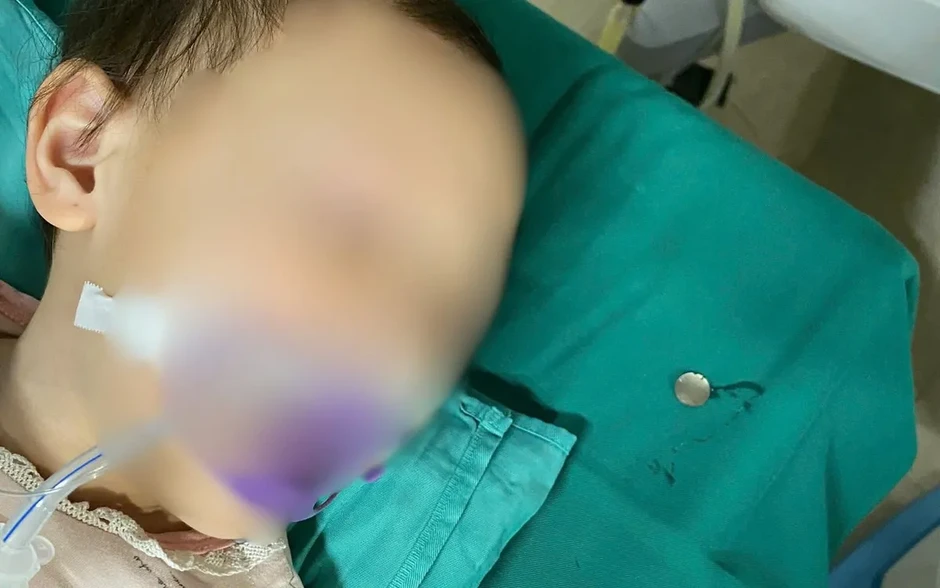 Nội soi gắp dị vật kim loại, cứu sống bé 3 tuổi Nội soi gắp dị vật kim loại, cứu sống bé 3 tuổi