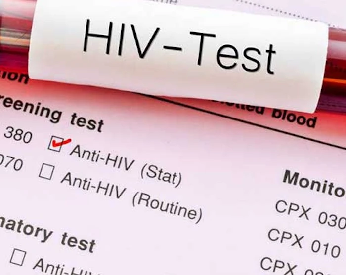 Nữ nghiên cứu sinh tiến sĩ 27 tuổi phát hiện nhiễm HIV, cách cô bị lây nhiễm khiến nhiều người "lạnh sống lưng" Nữ nghiên cứu sinh tiến sĩ 27 tuổi phát hiện nhiễm HIV, cách cô bị lây nhiễm khiến nhiều người "lạnh sống lưng"
