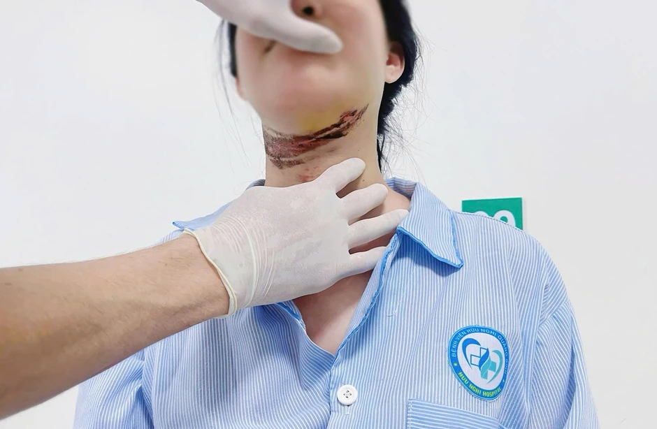 Nữ sinh nhập viện vì dây điện chùng ngang đường cuốn vào cổ Nữ sinh nhập viện vì dây điện chùng ngang đường cuốn vào cổ