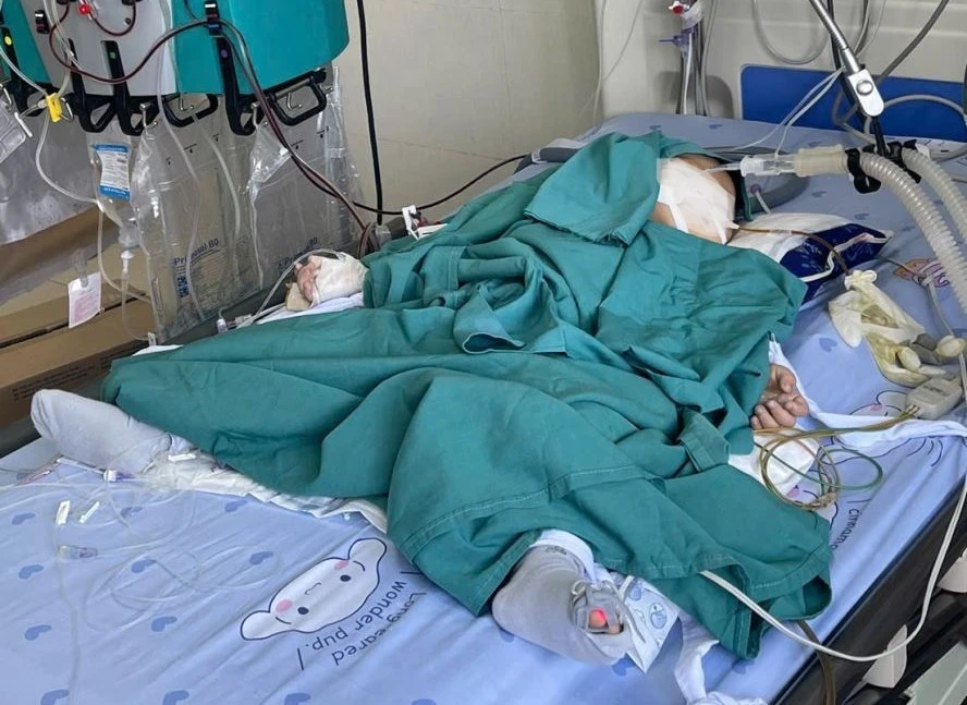 Nuốt nhầm hóa chất thí nghiệm, bé 2 tuổi nhập viện lọc máu Nuốt nhầm hóa chất thí nghiệm, bé 2 tuổi nhập viện lọc máu