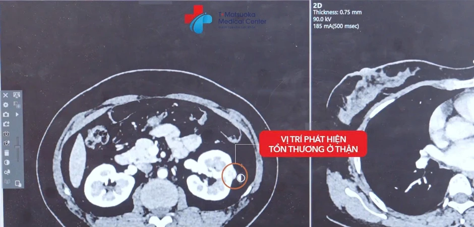 NURA Premium mở ra hành trình chăm sóc sức khỏe trọn vẹn chuẩn Nhật Bản NURA Premium mở ra hành trình chăm sóc sức khỏe trọn vẹn chuẩn Nhật Bản
