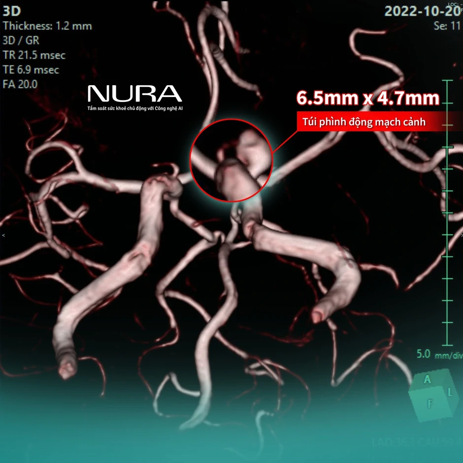 NURA Premium mở ra hành trình chăm sóc sức khỏe trọn vẹn chuẩn Nhật Bản NURA Premium mở ra hành trình chăm sóc sức khỏe trọn vẹn chuẩn Nhật Bản