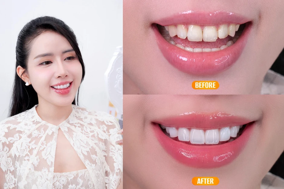 Parkview Dental: Nâng tầm nụ cười với 'Tiêu chuẩn Vàng' an tâm cùng 'Giá trị Thật' Parkview Dental: Nâng tầm nụ cười với 'Tiêu chuẩn Vàng' an tâm cùng 'Giá trị Thật'