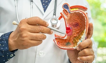 Phát hiện ung thư dạ dày di căn từ khối u ở cổ