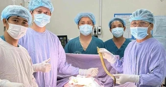 Phẫu thuật lấy con lươn dài 50cm, chui đường hậu môn vào bụng của bệnh nhân