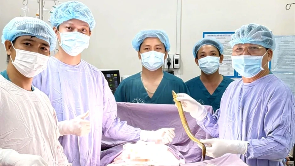 Phẫu thuật lấy con lươn dài khoảng 50cm chui trong bụng người đàn ông Phẫu thuật lấy con lươn dài khoảng 50cm chui trong bụng người đàn ông