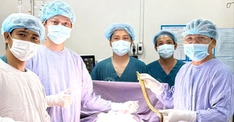 Phẫu thuật lấy con lươn dài khoảng 50cm chui trong bụng người đàn ông