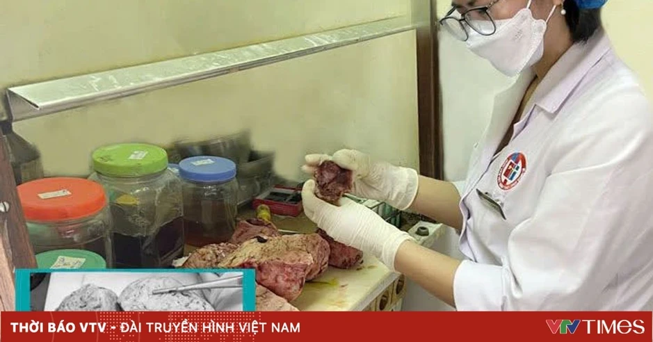 Phẫu thuật thành công khối u tử cung nặng 5kg cho người bệnh Phẫu thuật thành công khối u tử cung nặng 5kg cho người bệnh