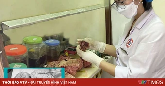 Phẫu thuật thành công khối u tử cung nặng 5kg cho người bệnh