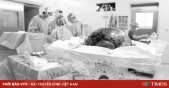 Phẫu thuật thành công khối u xơ tử cung "khổng lồ"