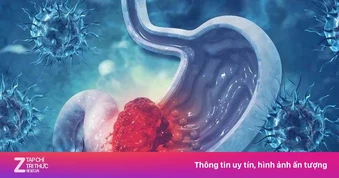 Phớt lờ dấu hiệu suốt nửa năm, người đàn ông mắc ung thư giai đoạn 3