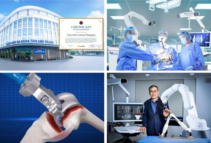 Robot AI thay khớp chuẩn xác đến 100% đầu tiên tại Việt Nam Robot AI thay khớp chuẩn xác đến 100% đầu tiên tại Việt Nam