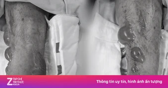 Sai lầm khi chữa đau chân khiến người đàn ông chịu hậu quả