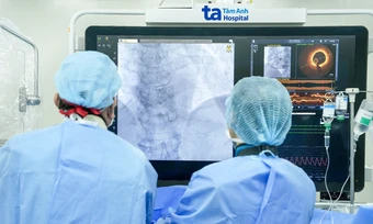 Sau đặt stent điều trị nhồi máu cơ tim cần lưu ý gì? - Báo TinVina