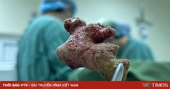 Sốc nhiễm trùng đường tiết niệu do sỏi - biến chứng nguy hiểm không nên chủ quan