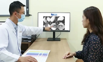 Sỏi amidan là gì? - Báo TinVina