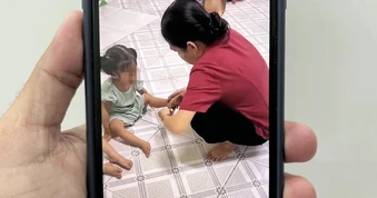 Sức khỏe 2 cháu bé bị giáo viên ở TPHCM dùng dây thun bắn hiện ra sao?