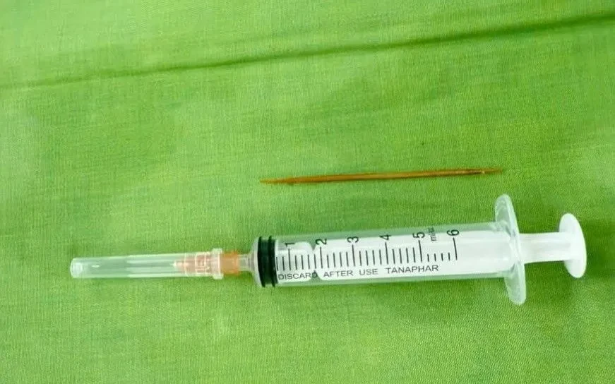 Tăm tre xuyên thủng tá tràng vào gan bé trai sau 3 tuần nuốt phải Tăm tre xuyên thủng tá tràng vào gan bé trai sau 3 tuần nuốt phải