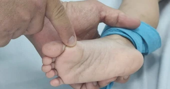 Tay chân miệng tăng cao, Bộ Y tế khuyến cáo “3 sạch” phòng bệnh