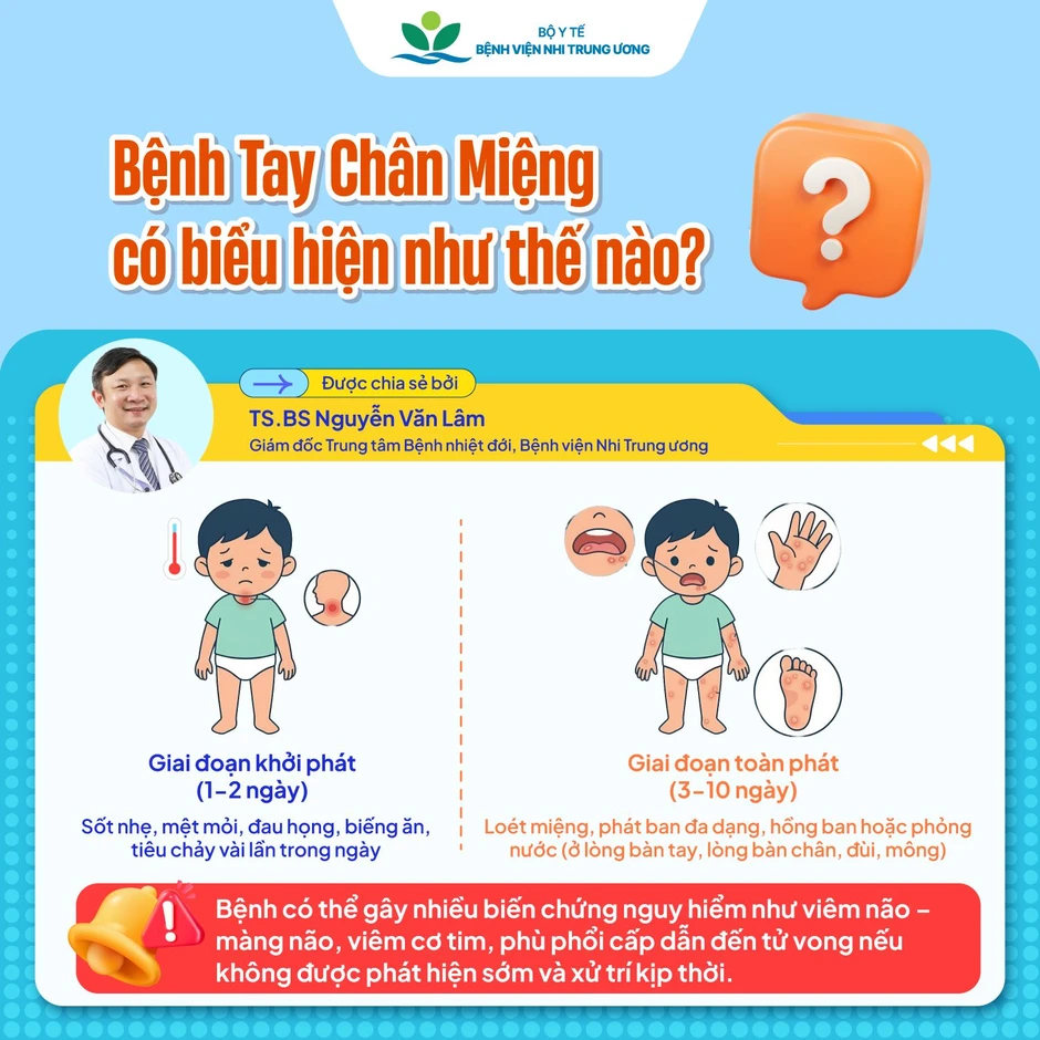 Tay chân miệng vào mùa: Trẻ có thể mắc nhiều lần, dễ chuyển nặng nếu chủ quan Tay chân miệng vào mùa: Trẻ có thể mắc nhiều lần, dễ chuyển nặng nếu chủ quan