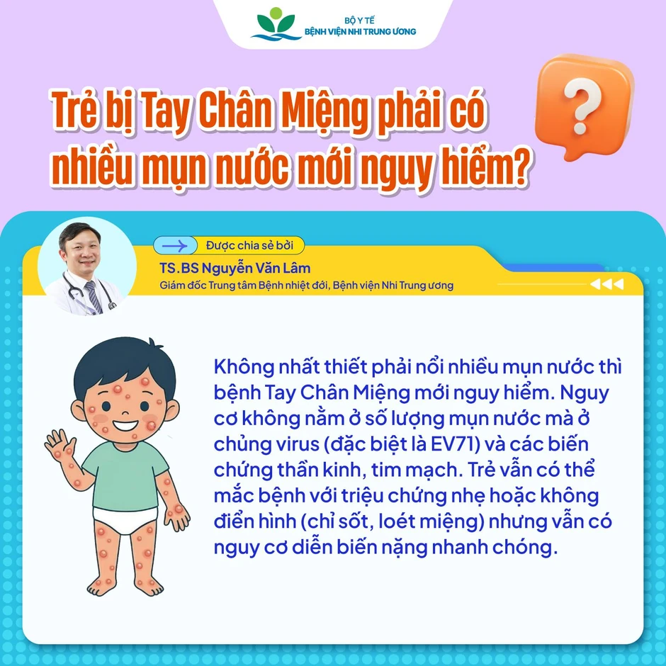 Tay chân miệng vào mùa: Trẻ có thể mắc nhiều lần, dễ chuyển nặng nếu chủ quan Tay chân miệng vào mùa: Trẻ có thể mắc nhiều lần, dễ chuyển nặng nếu chủ quan