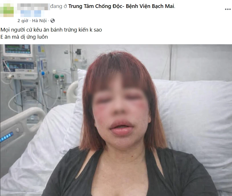 Tết Thanh Minh rủ nhau ăn bánh trứng kiến: Người khen “nổ bôm bốp vui miệng”, người thì… "đổi luôn giao diện" vì dị ứng Tết Thanh Minh rủ nhau ăn bánh trứng kiến: Người khen “nổ bôm bốp vui miệng”, người thì… "đổi luôn giao diện" vì dị ứng