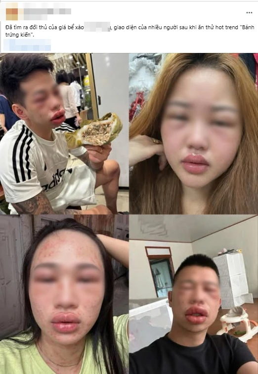 Tết Thanh Minh rủ nhau ăn bánh trứng kiến: Người khen “nổ bôm bốp vui miệng”, người thì… "đổi luôn giao diện" vì dị ứng Tết Thanh Minh rủ nhau ăn bánh trứng kiến: Người khen “nổ bôm bốp vui miệng”, người thì… "đổi luôn giao diện" vì dị ứng