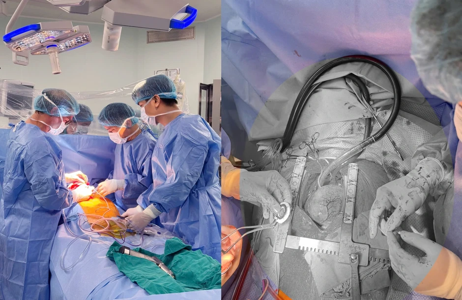 Thiết bị 90g mở thêm cơ hội cho bệnh nhân suy tim giai đoạn cuối Thiết bị 90g mở thêm cơ hội cho bệnh nhân suy tim giai đoạn cuối