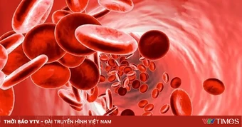Thiếu máu kéo dài do giun móc ký sinh