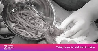Thiếu niên 15 tuổi bị loét ruột nặng, bên trong chứa đầy giun đũa