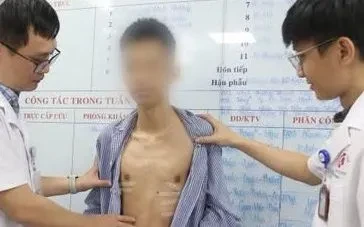 Thoát mặc cảm lõm ngực nhờ phẫu thuật ít xâm lấn Thoát mặc cảm lõm ngực nhờ phẫu thuật ít xâm lấn