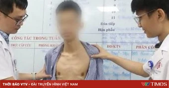 Thoát mặc cảm lõm ngực nhờ phẫu thuật ít xâm lấn