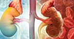 Thói quen hàng đầu gây hại cho thận: Nhiều người làm từ khi còn trẻ mà không biết