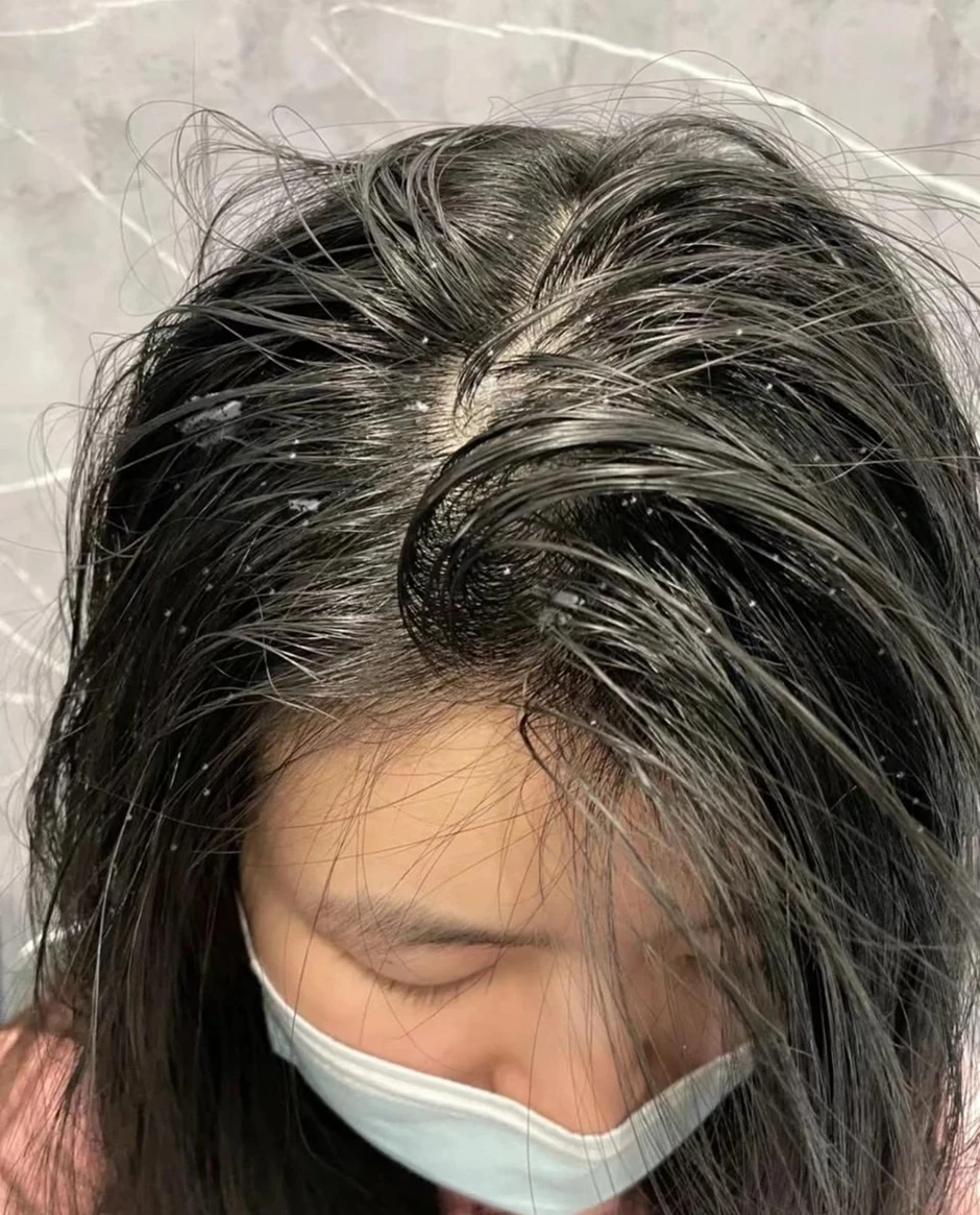 Thói quen tưởng sạch nhưng lại khiến da đầu mất cân bằng Thói quen tưởng sạch nhưng lại khiến da đầu mất cân bằng