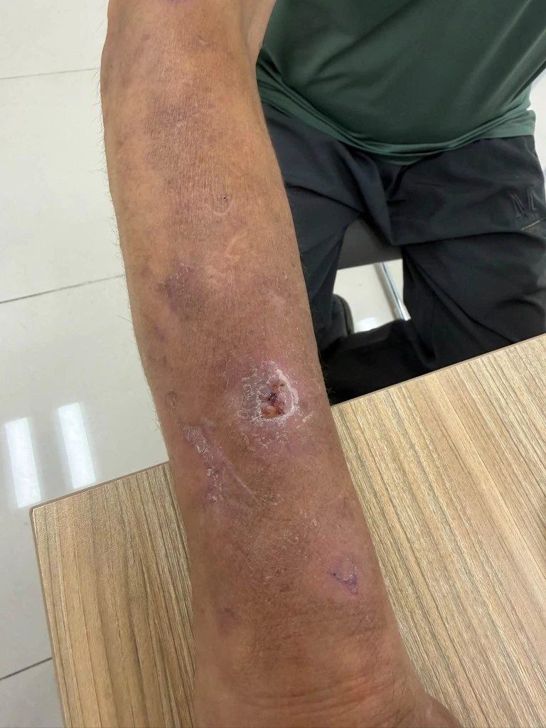 Thứ đáng sợ trong những viên thuốc mua theo quảng cáo: Người bệnh không biết mình đang đưa gì vào cơ thể dù nhớ rất rõ người quảng cáo là ai Thứ đáng sợ trong những viên thuốc mua theo quảng cáo: Người bệnh không biết mình đang đưa gì vào cơ thể dù nhớ rất rõ người quảng cáo là ai