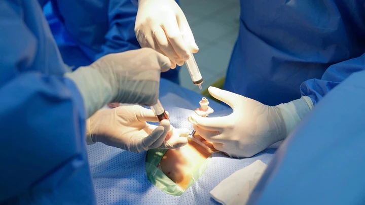 Thực hiện thành công ca ghép tuỷ từ người hiến nhỏ nhất Việt Nam Thực hiện thành công ca ghép tuỷ từ người hiến nhỏ nhất Việt Nam