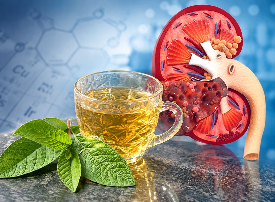 Thực hư chuyện "uống nước lá ổi hằng ngày gây hỏng thận" Thực hư chuyện "uống nước lá ổi hằng ngày gây hỏng thận"