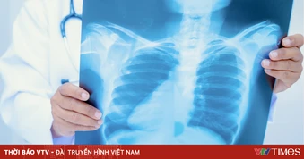 TP Hồ Chí Minh triển khai chiến dịch sàng lọc lao chủ động tại cộng đồng năm 2026