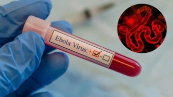 TP.HCM siết giám sát cửa khẩu, ngăn nguy cơ dịch Ebola xâm nhập cộng đồng
