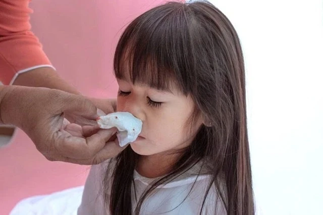 Trẻ hay chảy máu cam: Ăn gì để cải thiện nhanh và an toàn? Trẻ hay chảy máu cam: Ăn gì để cải thiện nhanh và an toàn?