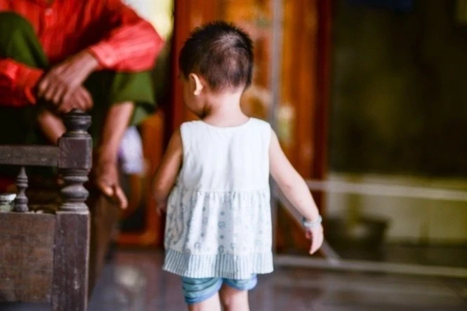 Trẻ ho kéo dài một tháng, bác sĩ phát hiện dị tật hiếm gặp Trẻ ho kéo dài một tháng, bác sĩ phát hiện dị tật hiếm gặp