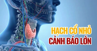 Trẻ xuất hiện hạch cổ, dấu hiệu nhỏ nhưng cảnh báo lớn
