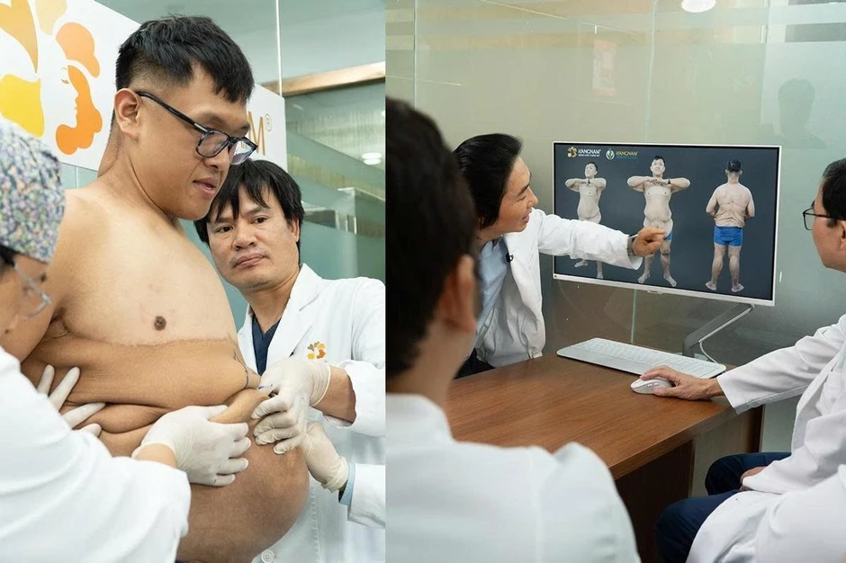 Trọng Nhân trải qua ca phẫu thuật cắt da lần thứ 3 với miếng da khổng lồ 8.1kg Trọng Nhân trải qua ca phẫu thuật cắt da lần thứ 3 với miếng da khổng lồ 8.1kg