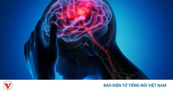Trước 9h sáng, làm điều này để phòng ngừa đột quỵ