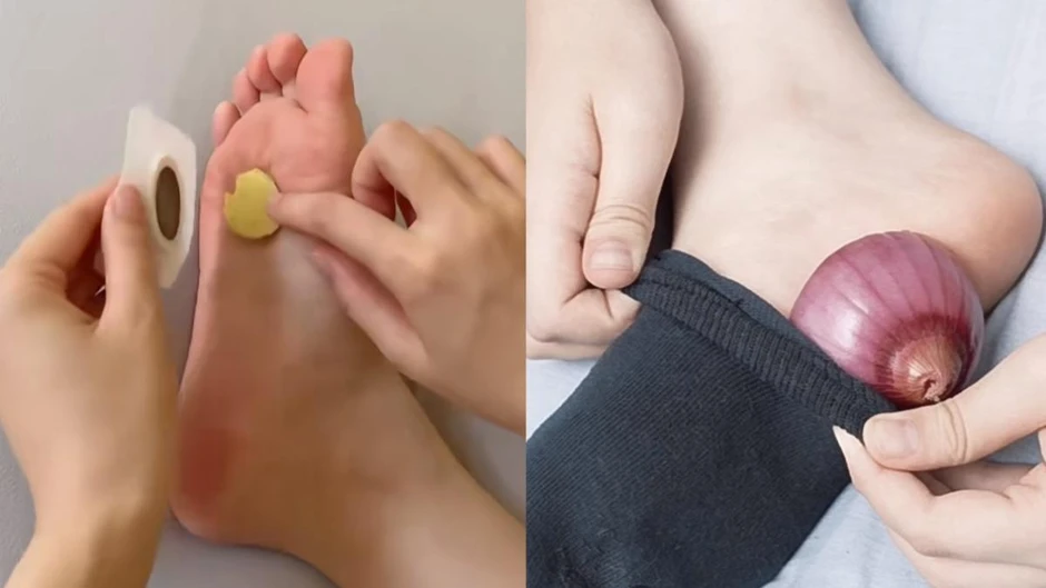Trước khi đi ngủ, nhiều người có thói quen đắp gừng, hành vào lòng bàn chân để ngủ ngon: Chuyên gia nói 1 câu ai cũng bất ngờ Trước khi đi ngủ, nhiều người có thói quen đắp gừng, hành vào lòng bàn chân để ngủ ngon: Chuyên gia nói 1 câu ai cũng bất ngờ